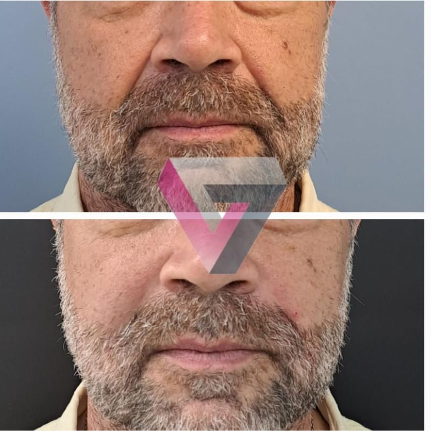 Victoria Trasmonte-100