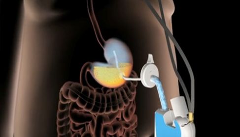 Román Turró Arau-7