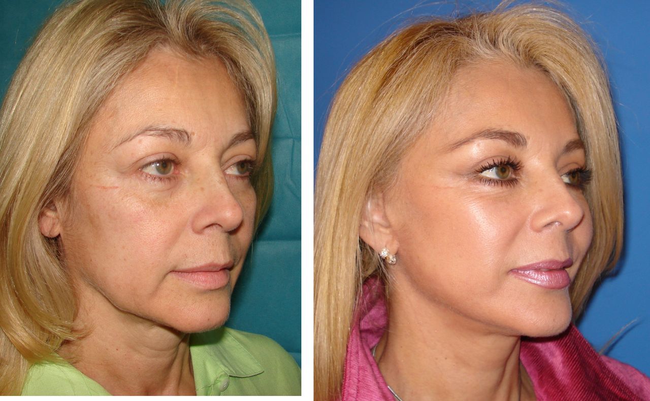 Jaime Eduardo Chacón Hernández-11