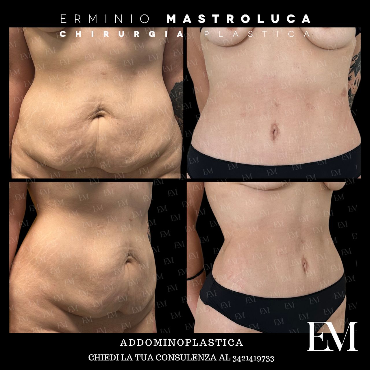 Erminio Mastroluca-14