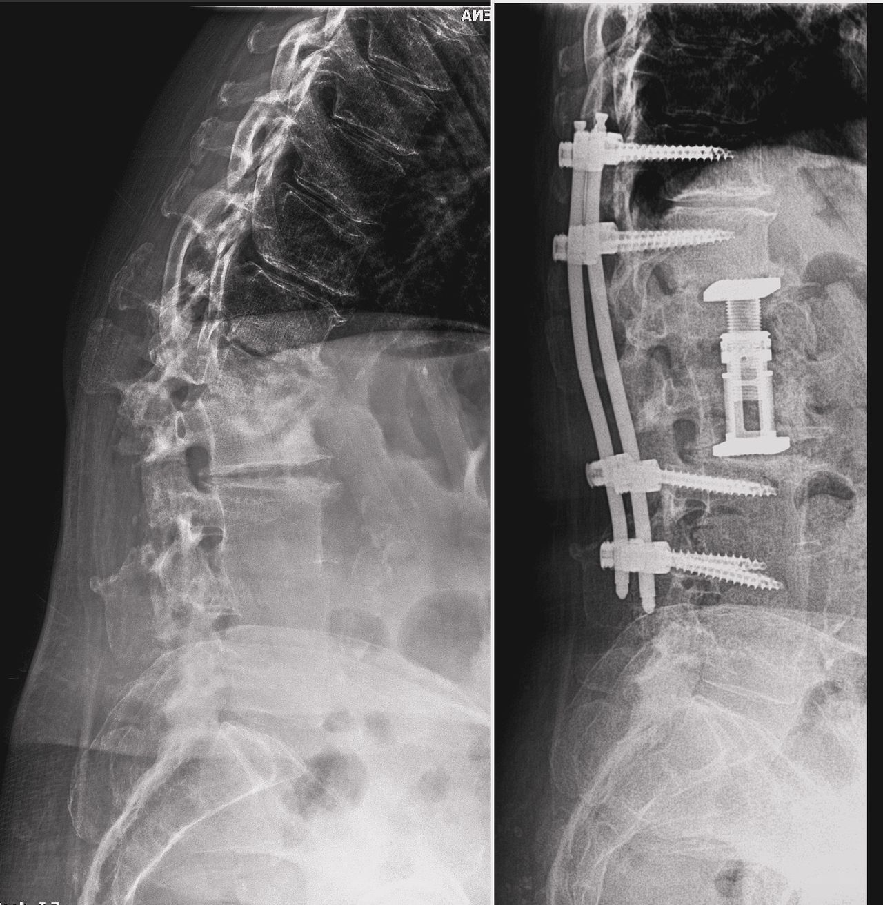 Federico Caporlingua-3