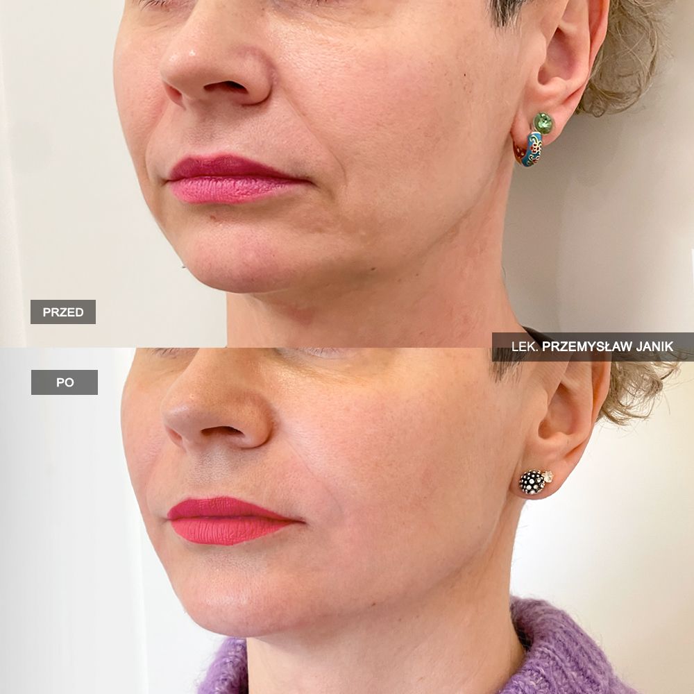 Przemysław Janik-34