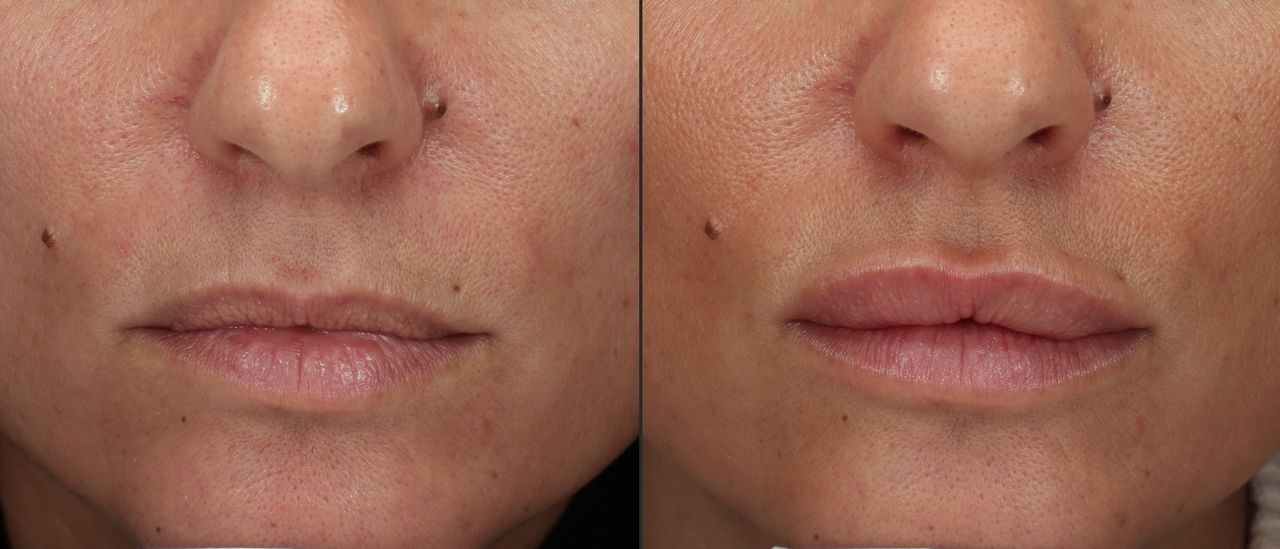 Giordano Vespasiani-22