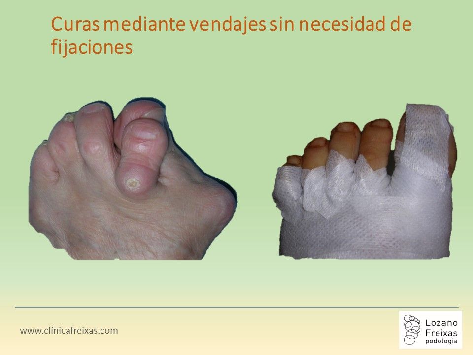 Joan Lozano Freixas-15