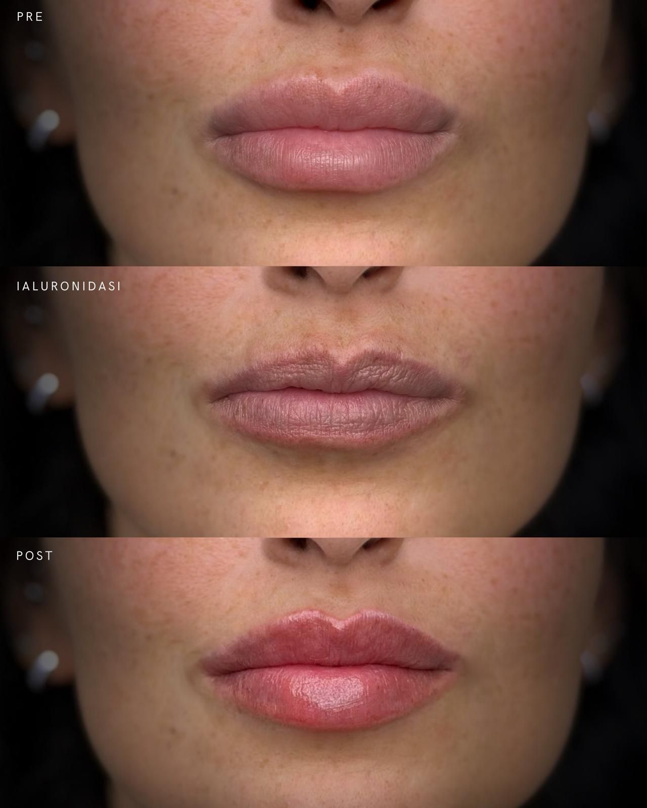 Maddalena Colecchia-16