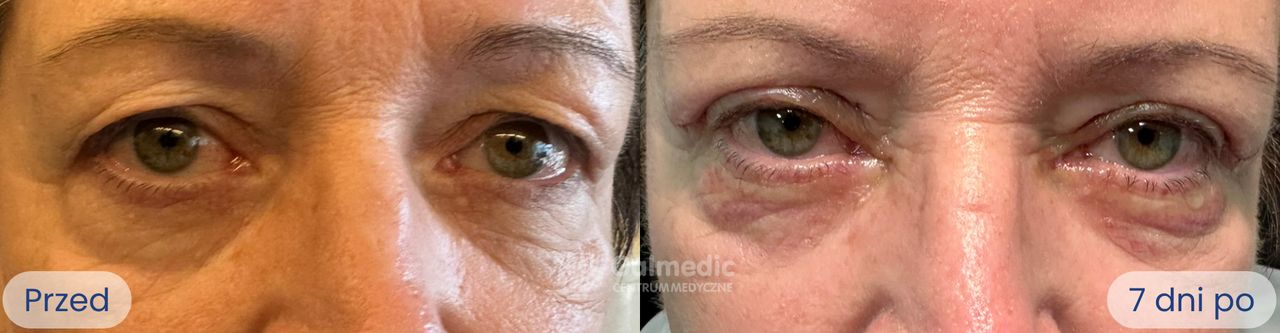 Jakub Staniszewski-6