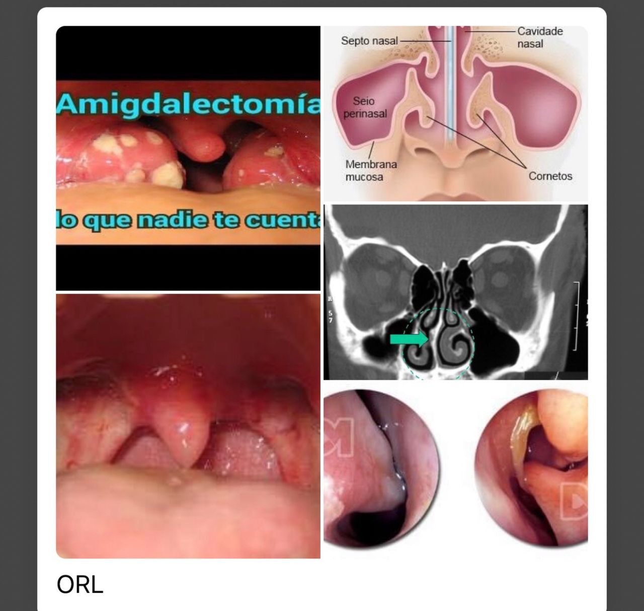 Ermidelia Candelaria Martin Lorenzo-16