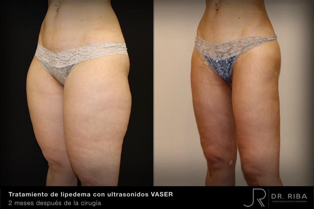 Jordi Riba Vilchez-18