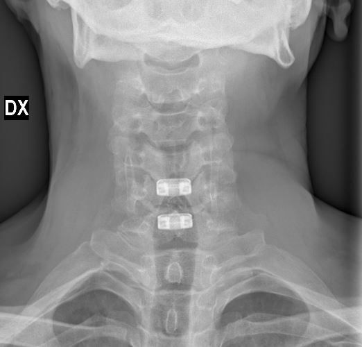 Alessandro Borderi-23