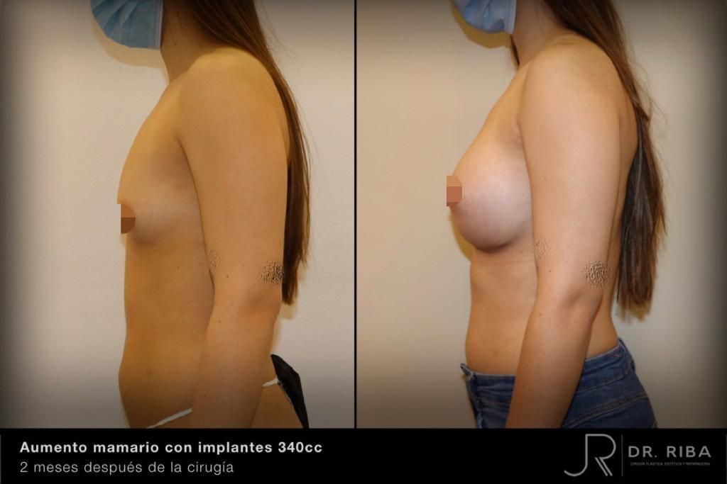 Jordi Riba Vilchez-9