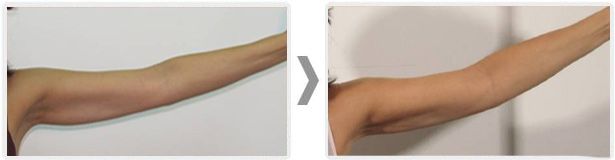 Anita Orzechowska-20