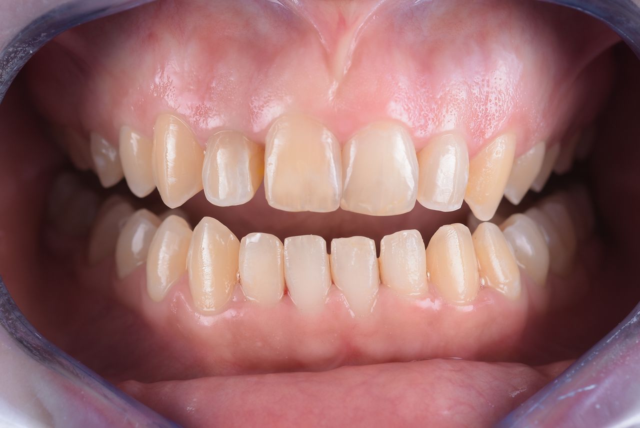 Riccardo Giardina-28