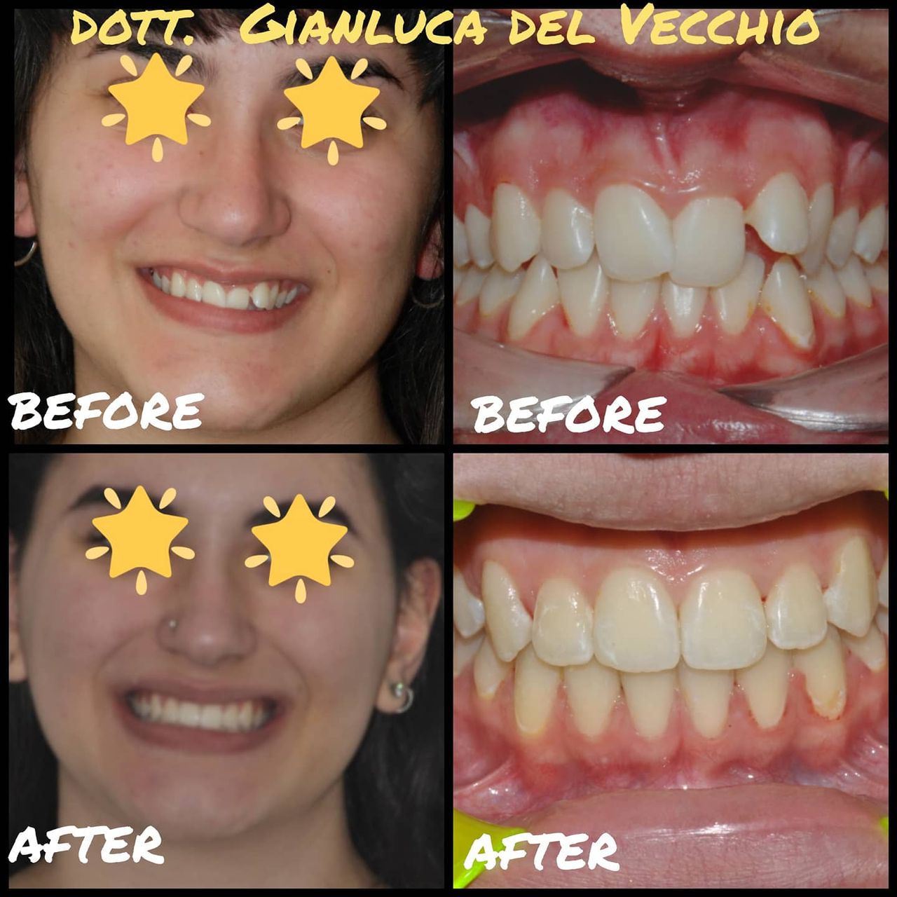 Gianluca Del Vecchio-38