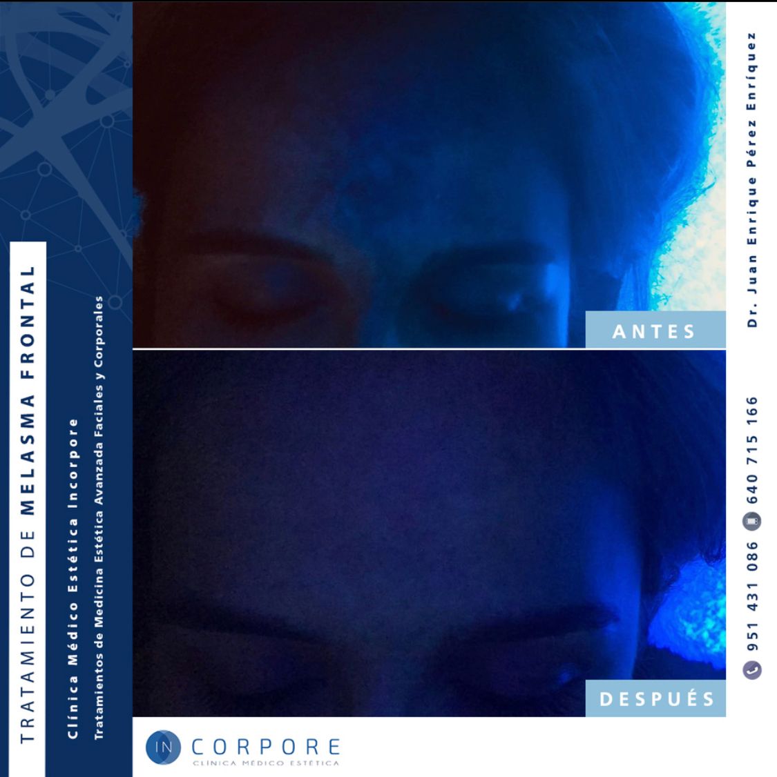 Juan Enrique Pérez Enríquez-123