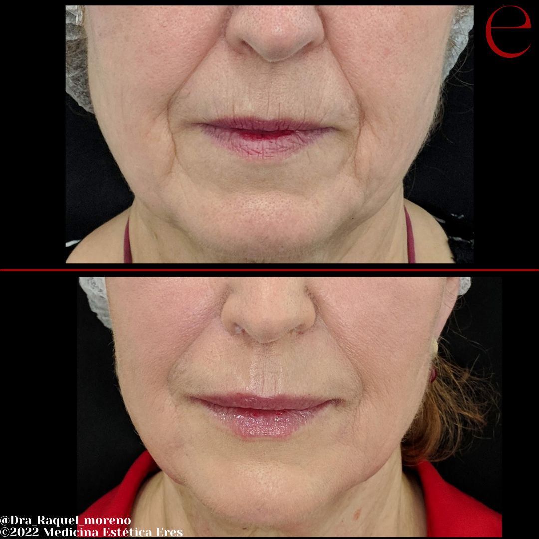 Raquel Moreno Pentinel-82