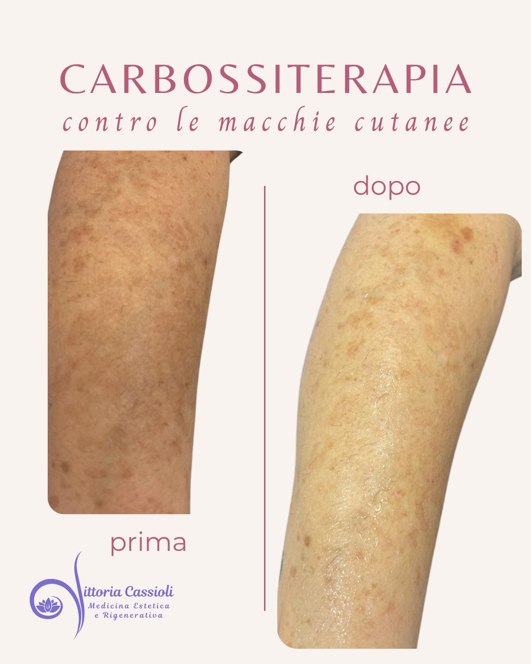 Vittoria Cassioli-49