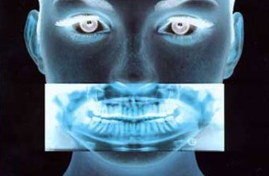 Hansjörg Häussermann-1