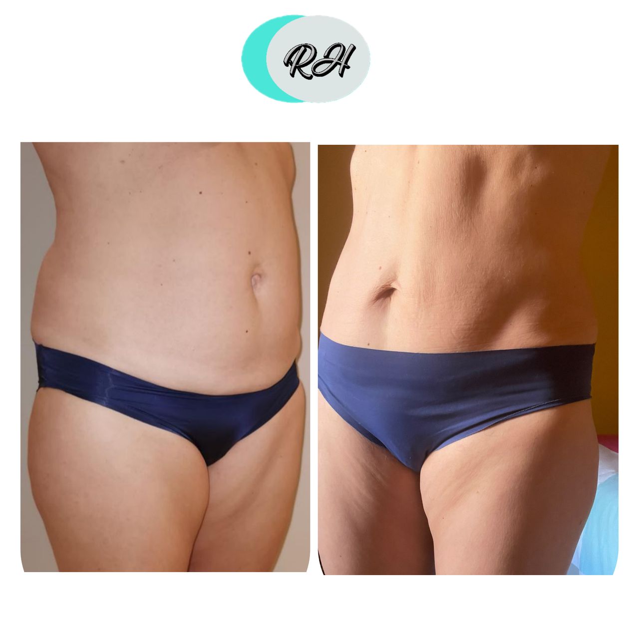 Rosalba Herrero Zerpa-177