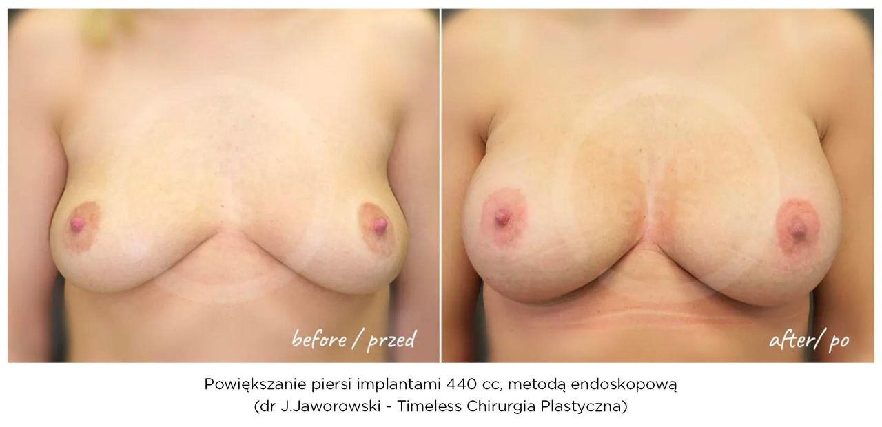 Janusz Jaworowski-132