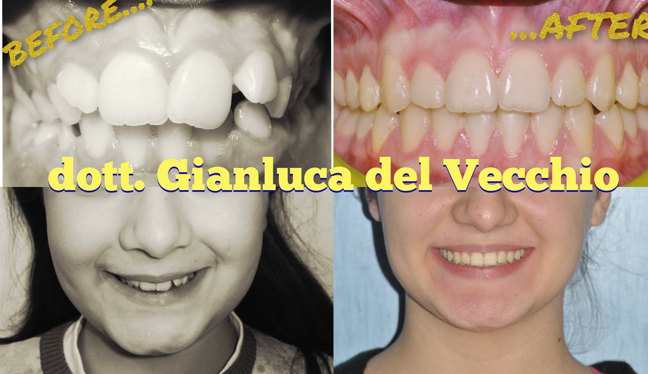 Gianluca Del Vecchio-56