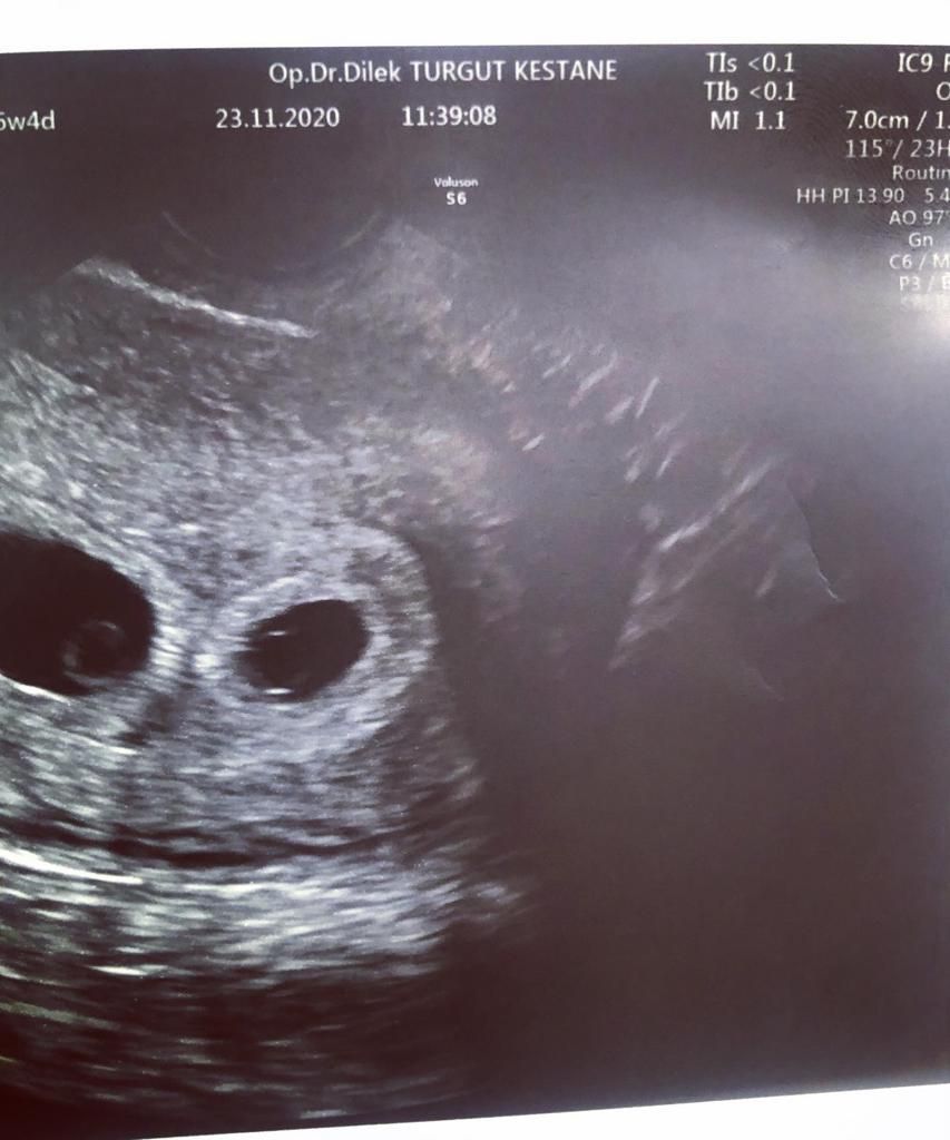 Dilek Turğut Kestane-4