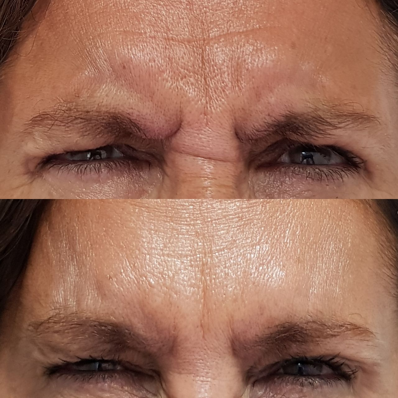 Rosalba Herrero Zerpa-311