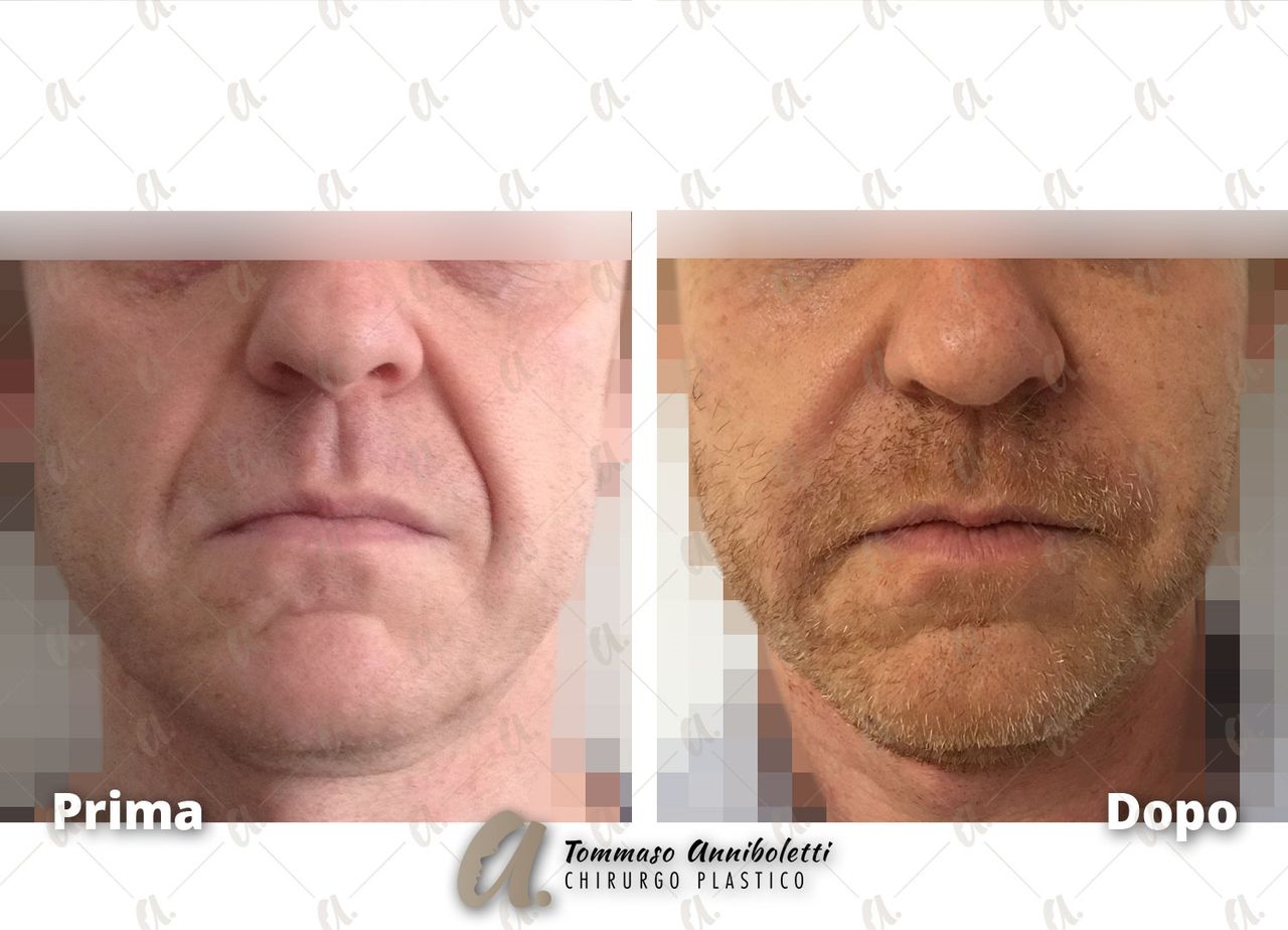 Tommaso Anniboletti-48