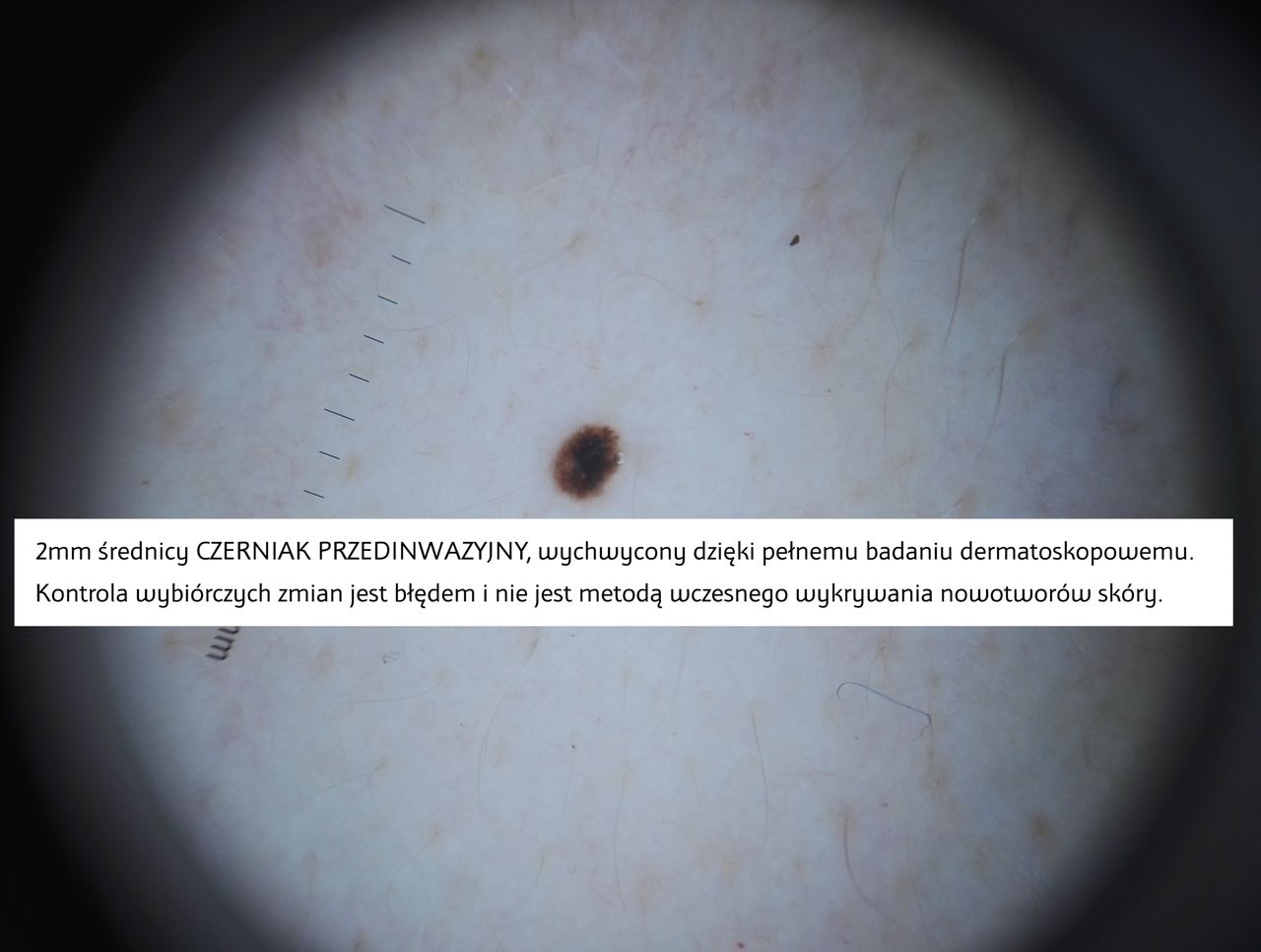 Paweł Pietkiewicz-1