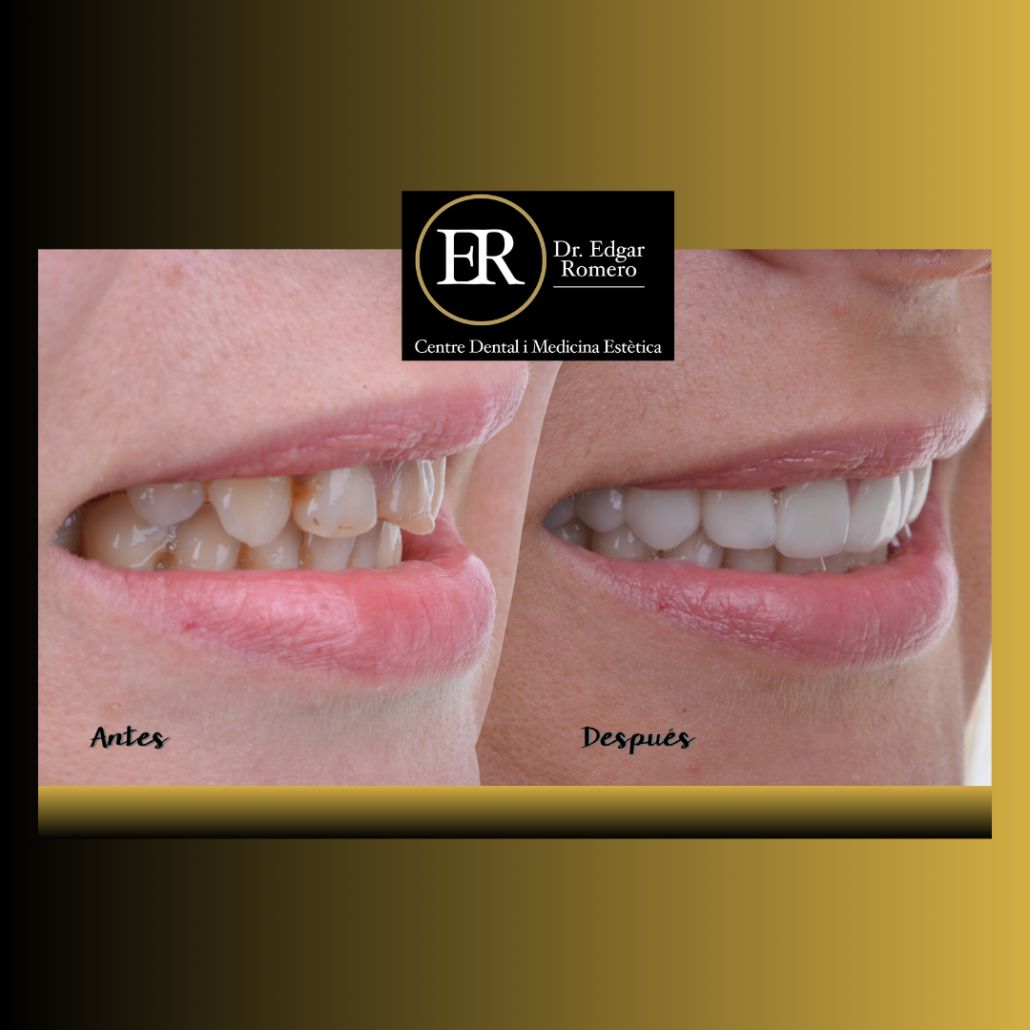 Edgar Teddy Romero Pelaez-1