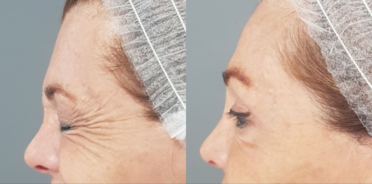 Rosalba Herrero Zerpa-497