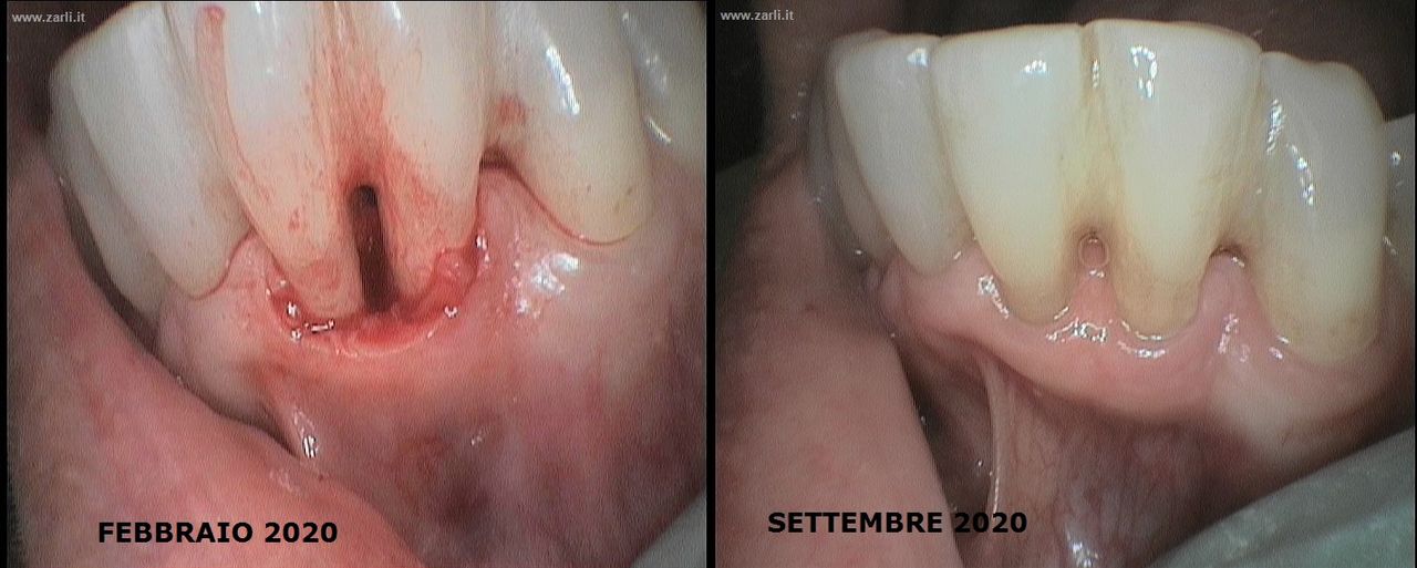 Francesco Dell'andrea-6