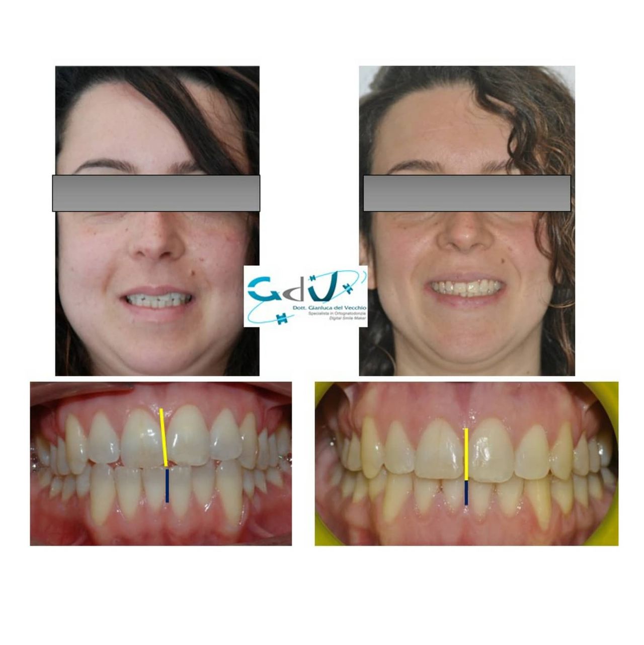 Gianluca Del Vecchio-99