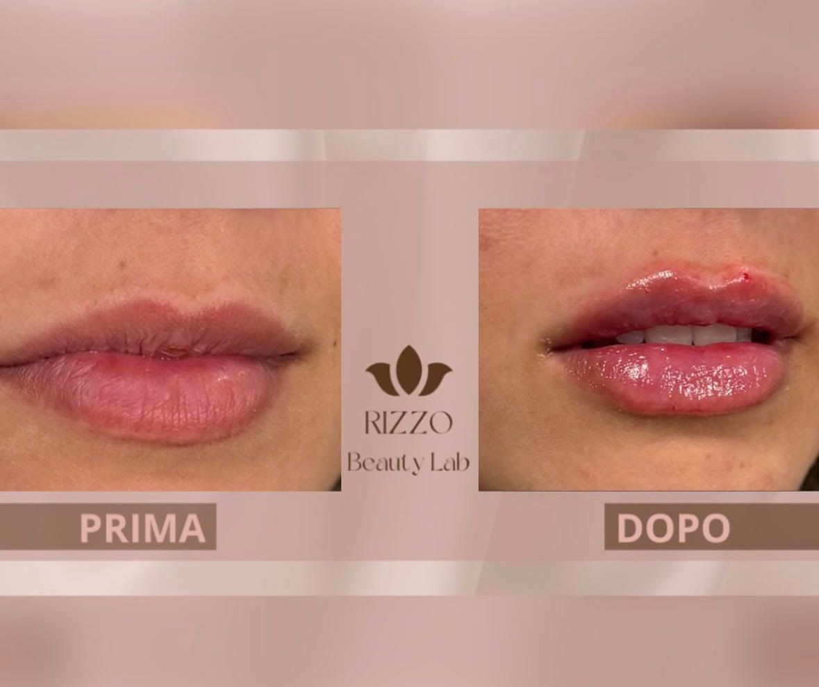 Giorgio Rizzo-3