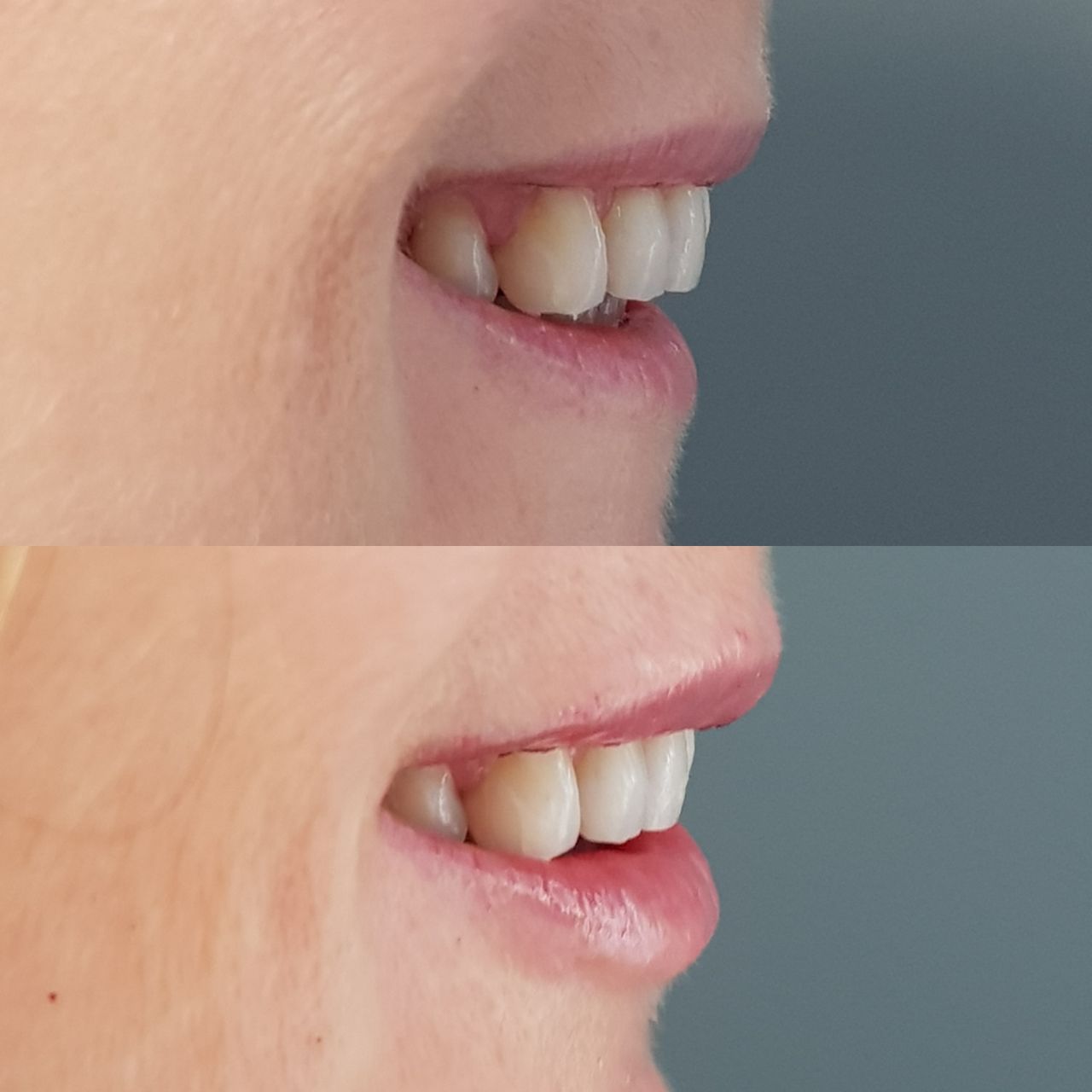 Rosalba Herrero Zerpa-195