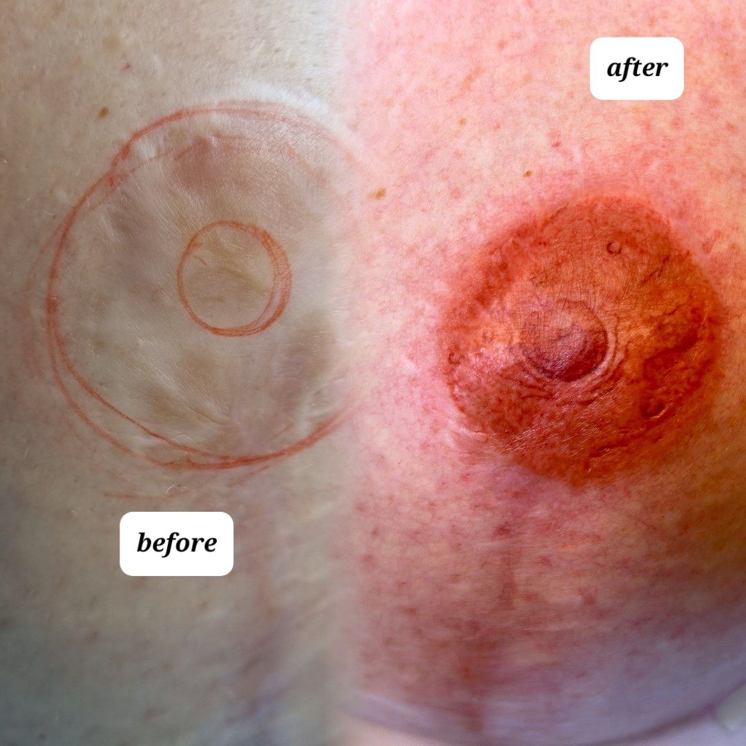 Ascensión Nuevo Hurtado-1