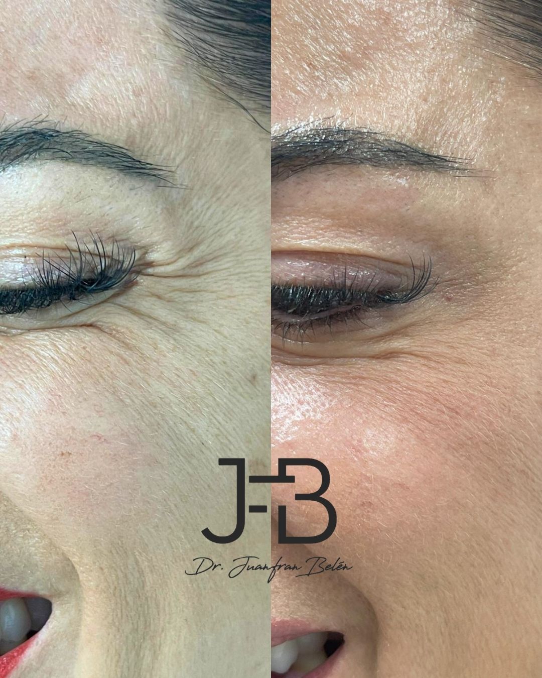 Juan Francisco Belén Montero-40