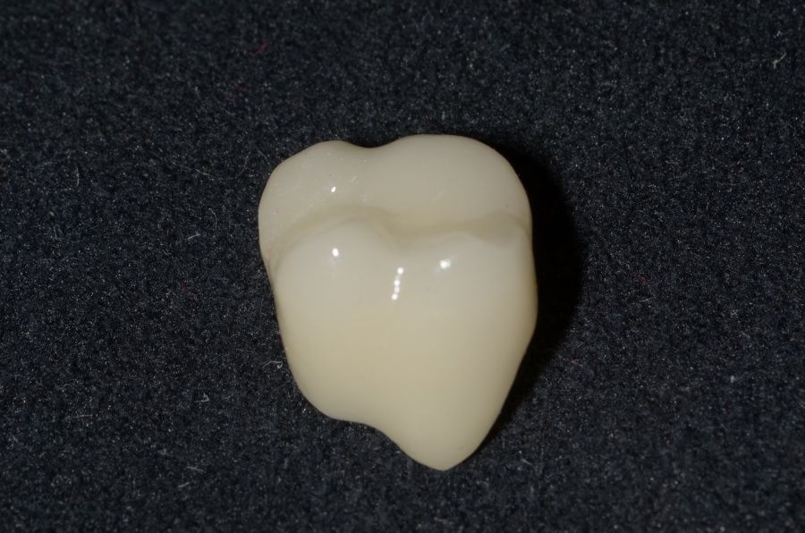 Berthold Kratzenstein-6