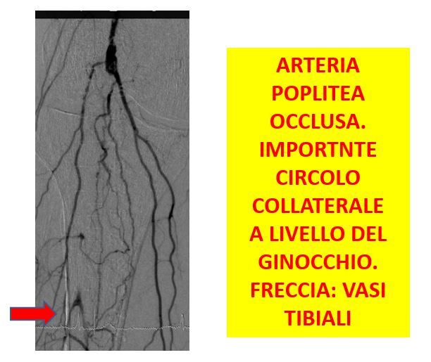 Gianni De Angelis-11