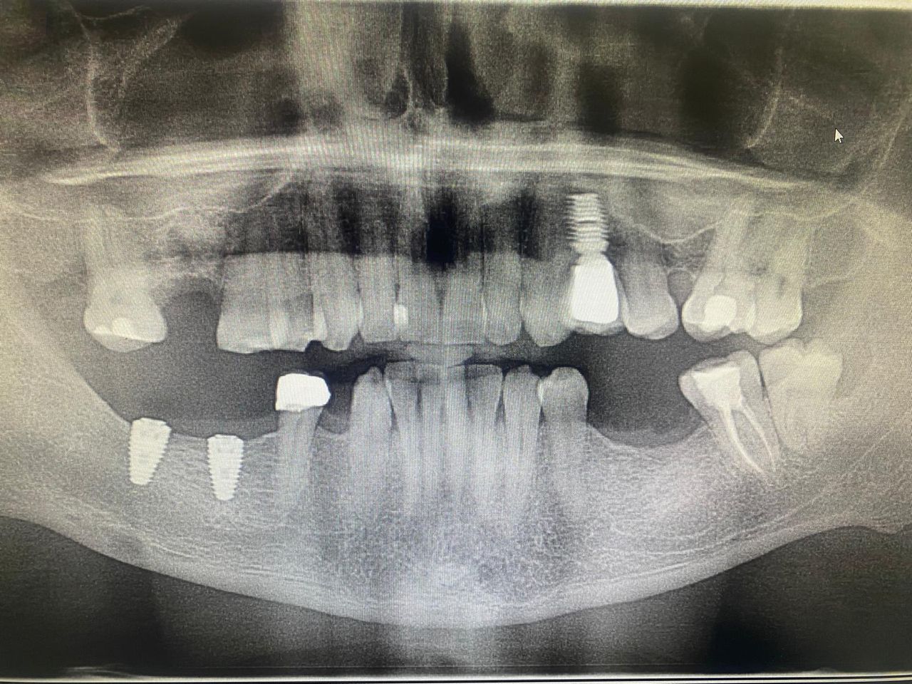 Luigi Giuseppe Romano-15