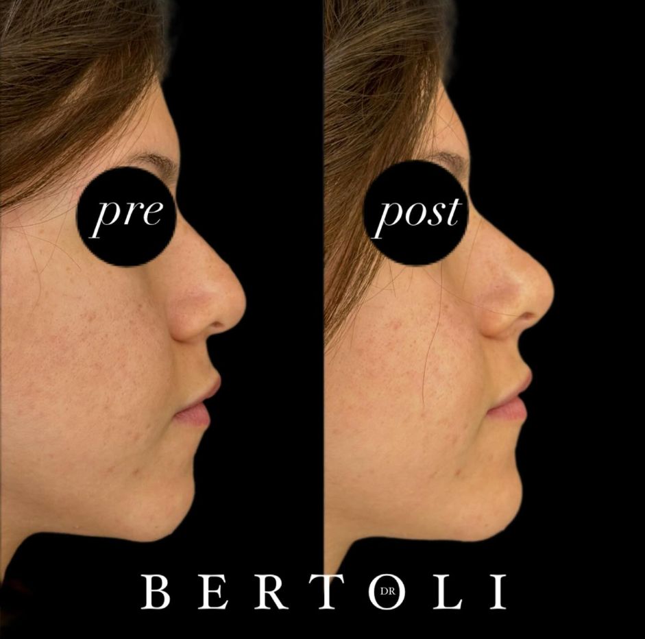 Andrea Bertoli-15
