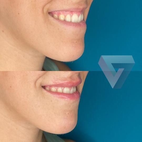 Victoria Trasmonte-44