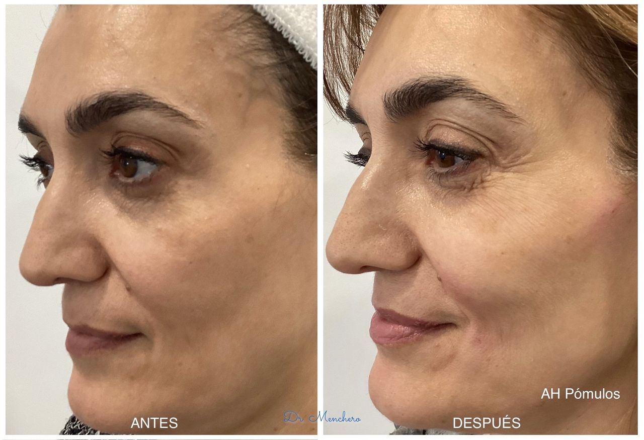 Arsenio Menchero Sánchez-13