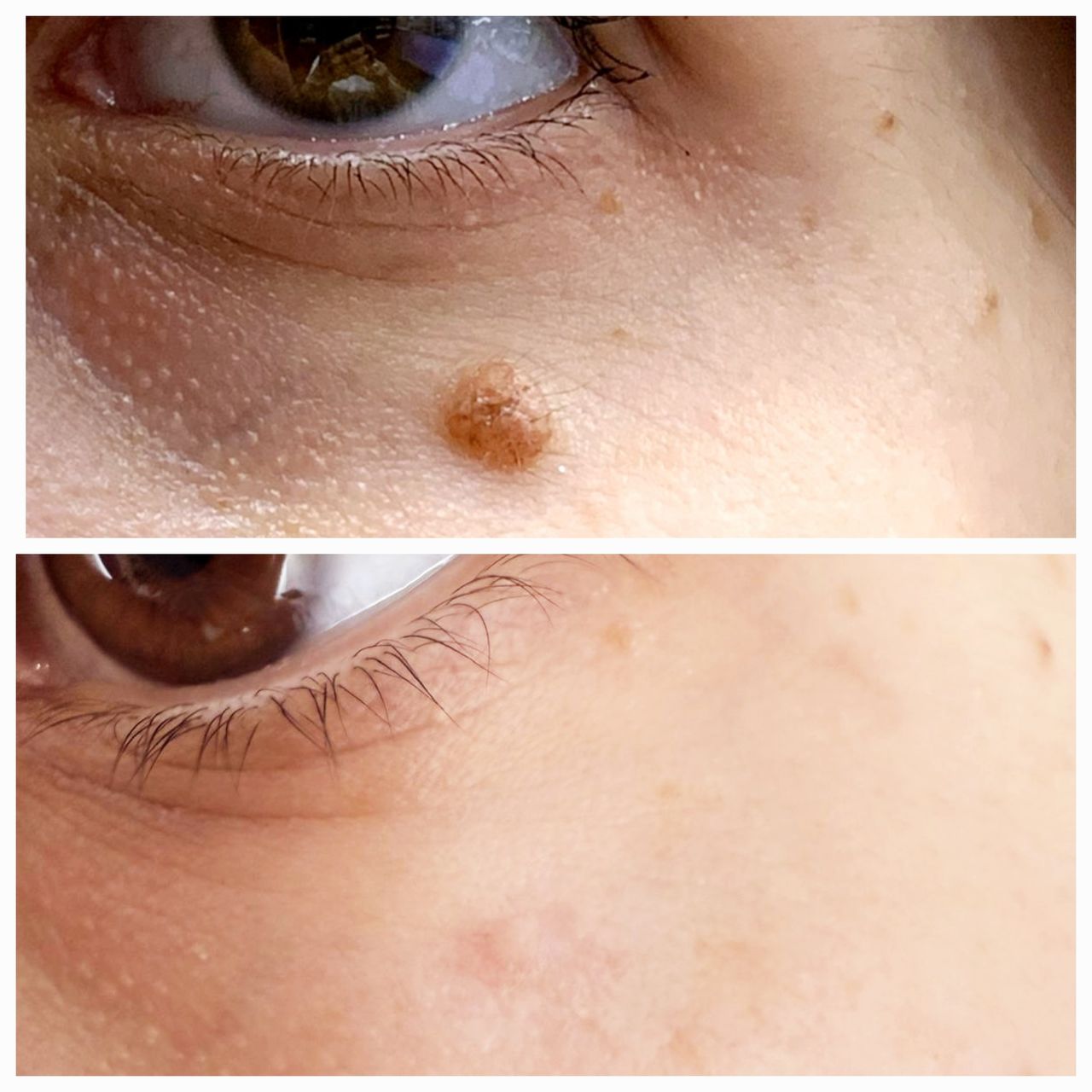 Rosalba Herrero Zerpa-557