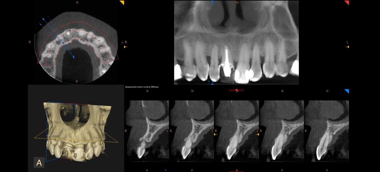 Gustavo Nefa Gaillez-6