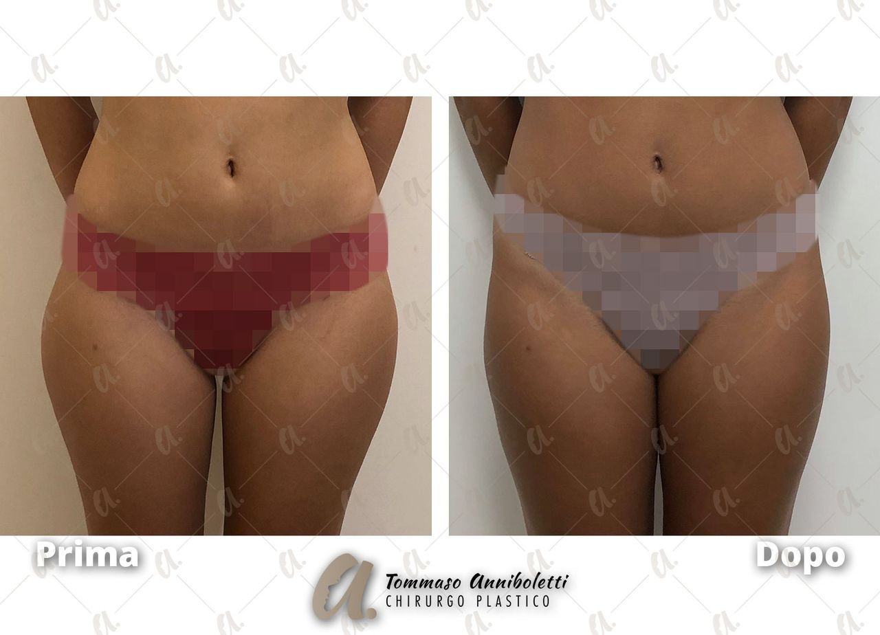 Tommaso Anniboletti-50