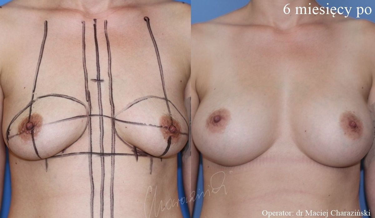 Maciej Charaziński-117