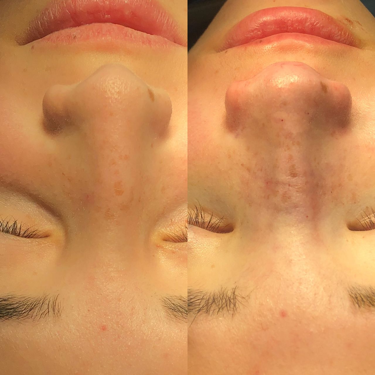 Alberto Candau Álvarez-20