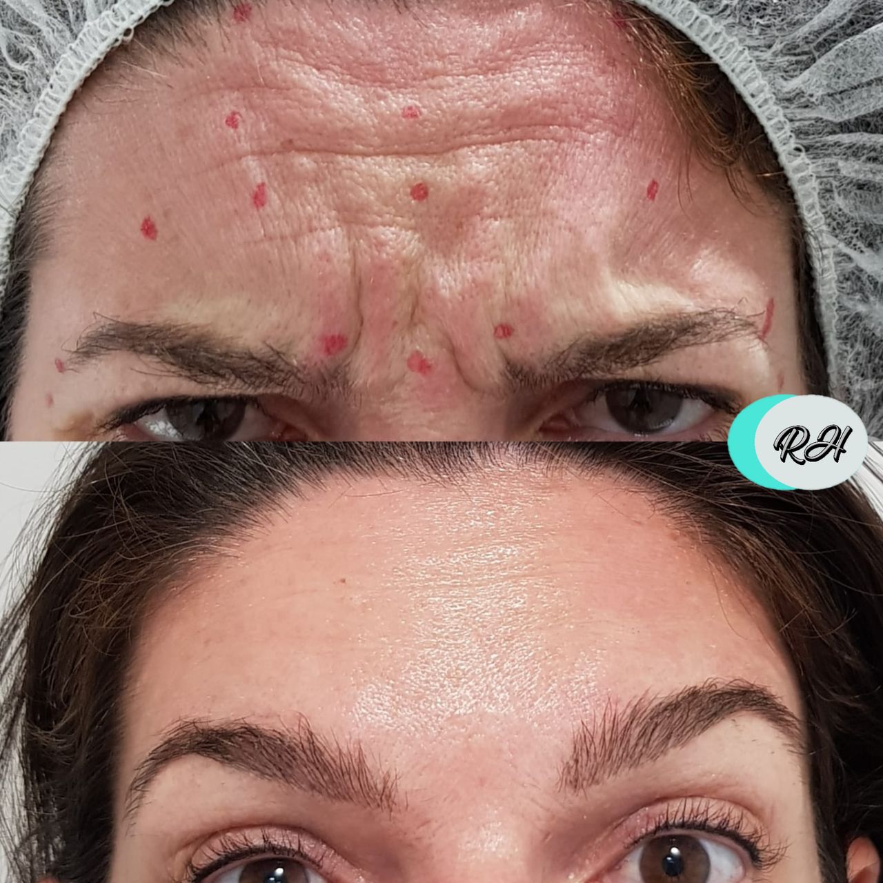 Rosalba Herrero Zerpa-143