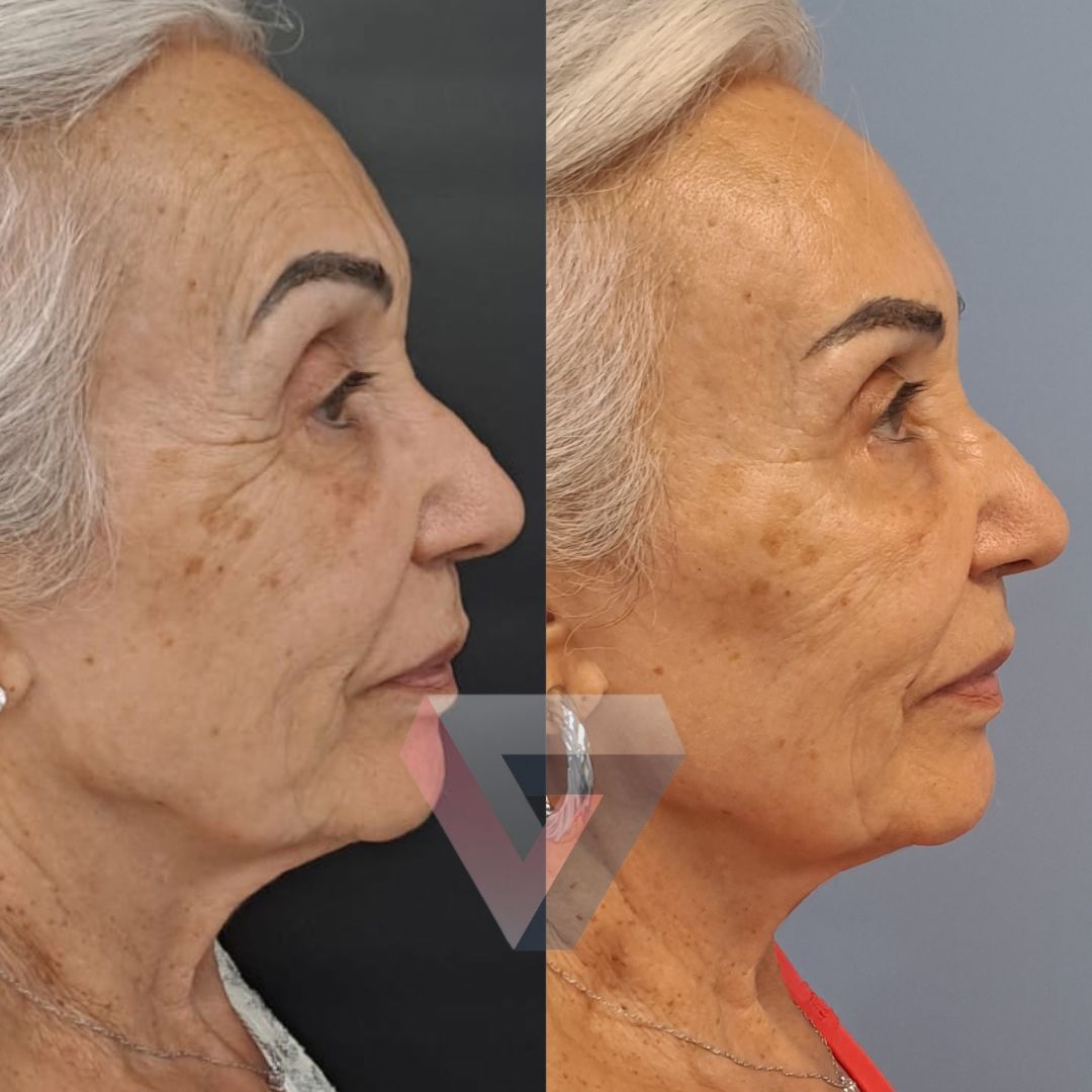 Victoria Trasmonte-124