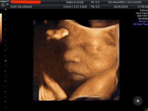 José Antonio Navarro Repiso-5